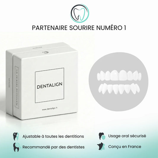 Facettes Amovibles - Dentalign™